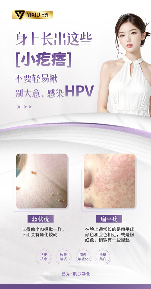 已秀连锁减肥