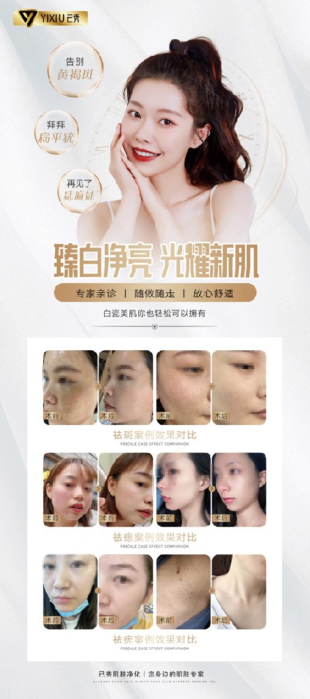 已秀合作电话合作