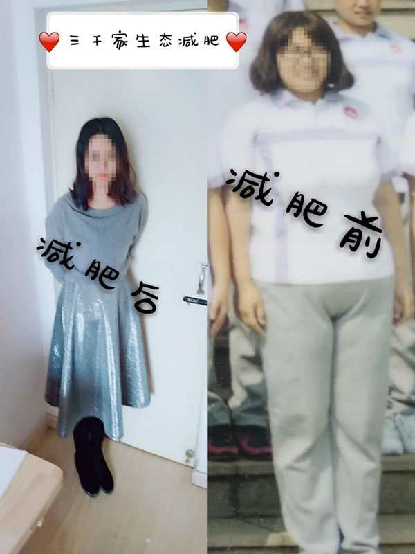 局部减肥瘦肚子效果好